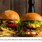 How Long After Wisdom Teeth Removal Can I Eat a Burger?