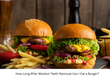 How Long After Wisdom Teeth Removal Can I Eat a Burger?