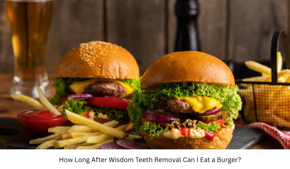 How Long After Wisdom Teeth Removal Can I Eat a Burger?
